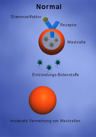 Ursache der Mastozytose: gesunde Mastzellen tragen den Tyrosin-Rezeptor KIT.