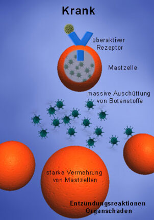 Ursachen Und Verlauf Der Mastozytose | Selbsthilfe Netzwerk